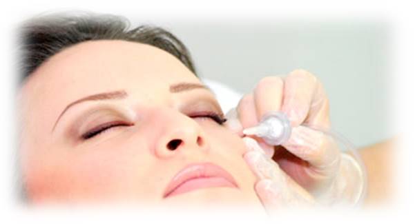 Carboxiterapia Facial