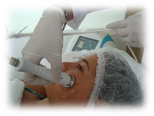 Radiofrequência Facial